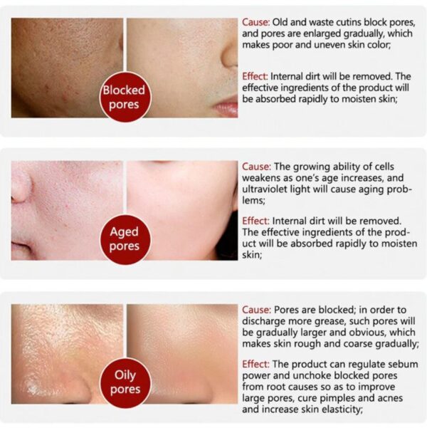 Rorec Moisturizing Anti Wrinkle Rice Face Serum for Open Pores - Image 2